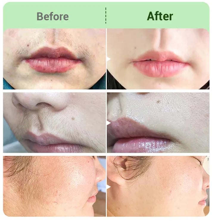 💥BUY 2 GET 1 FREE💥🍃Hair Removal Cream Kit for Women