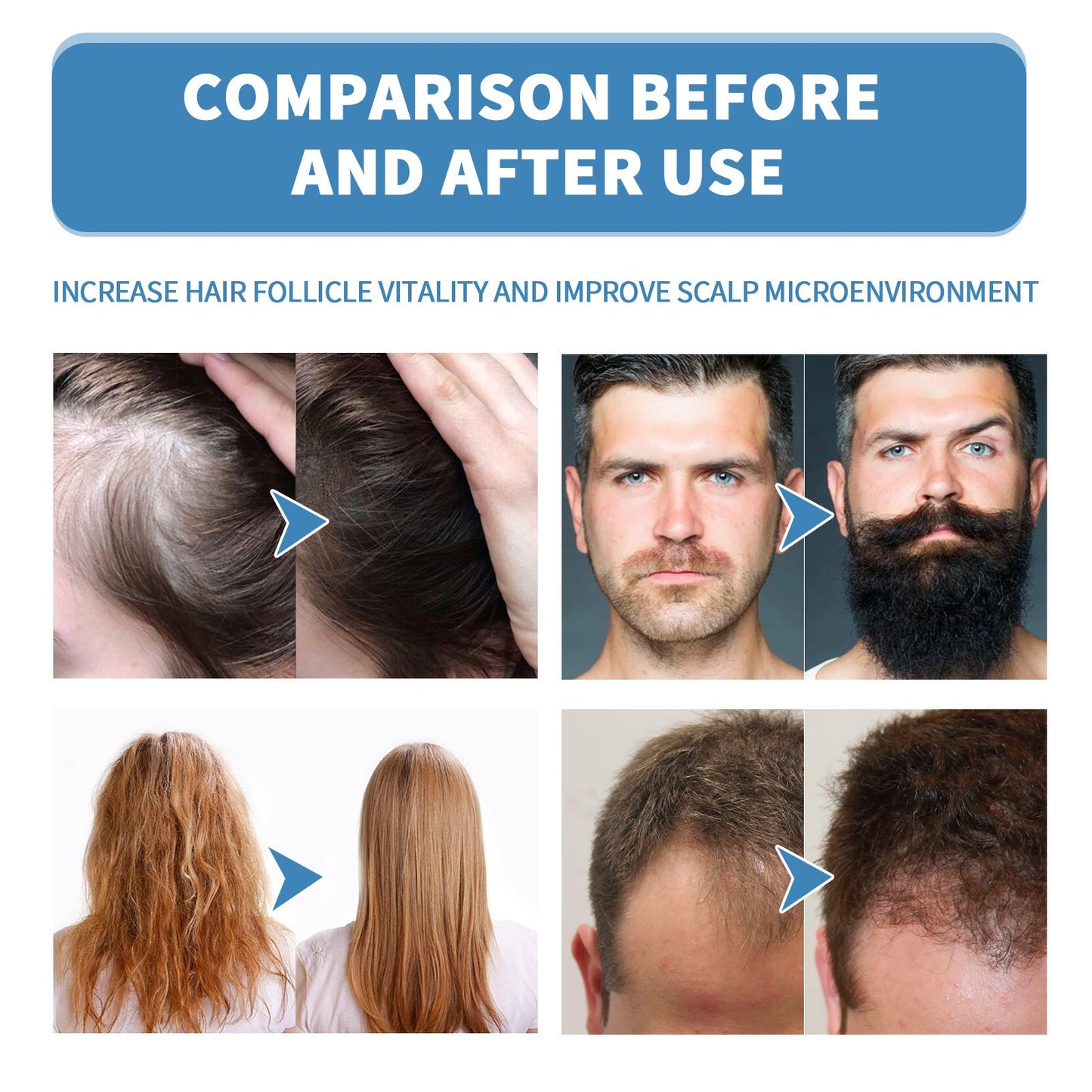 🌿EAST MOON Minoxi Roll-On Hair Treatment