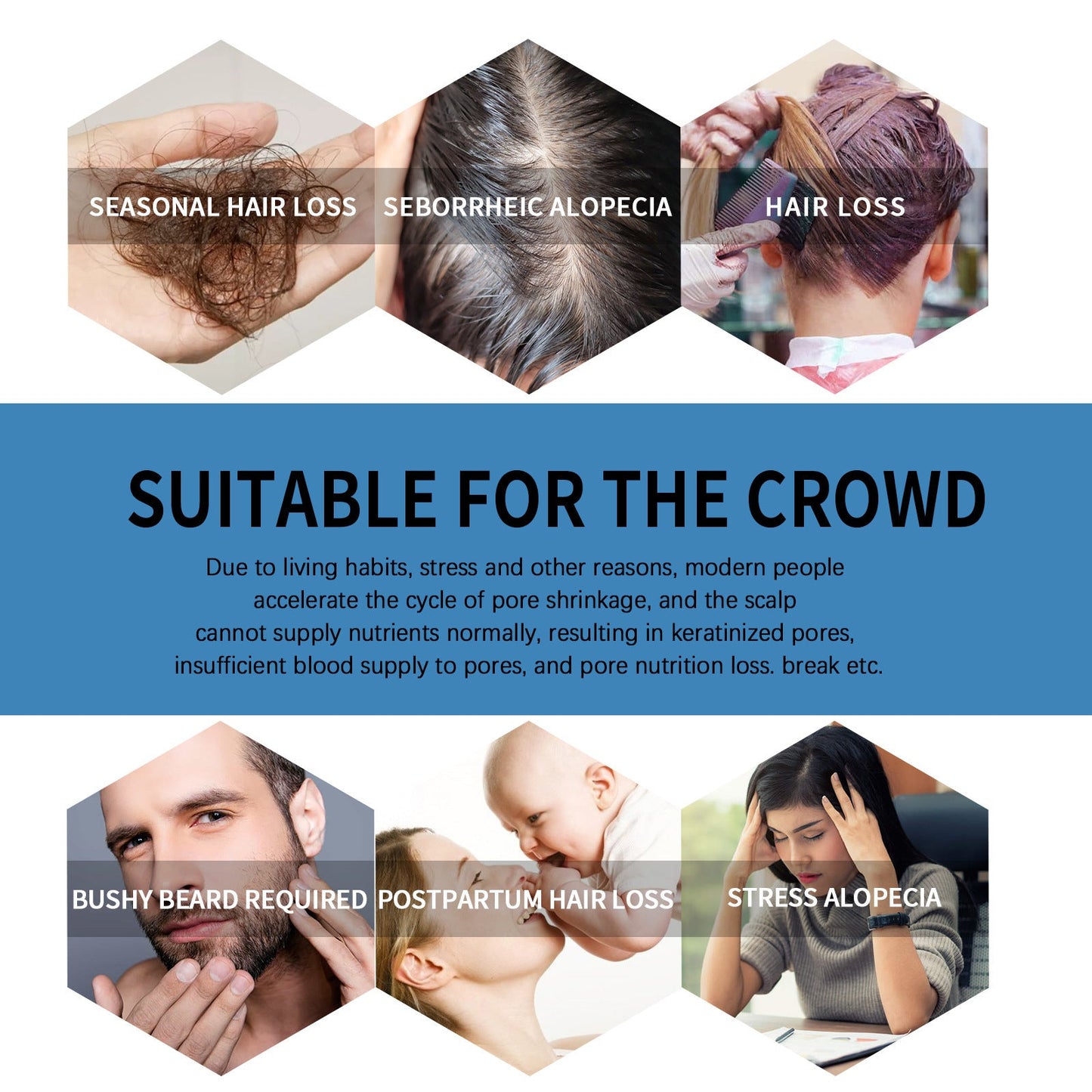 🌿EAST MOON Minoxi Roll-On Hair Treatment