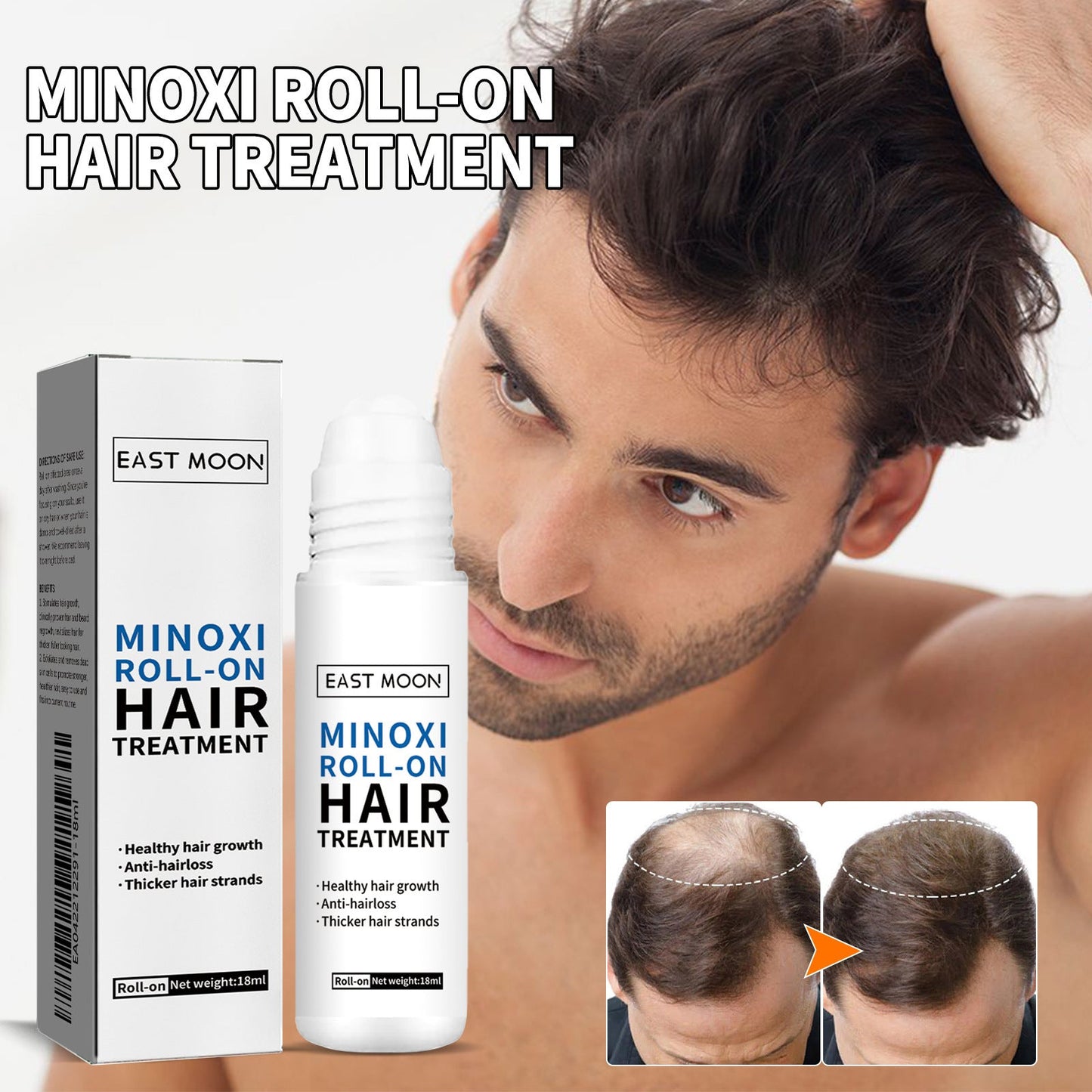 🌿EAST MOON Minoxi Roll-On Hair Treatment
