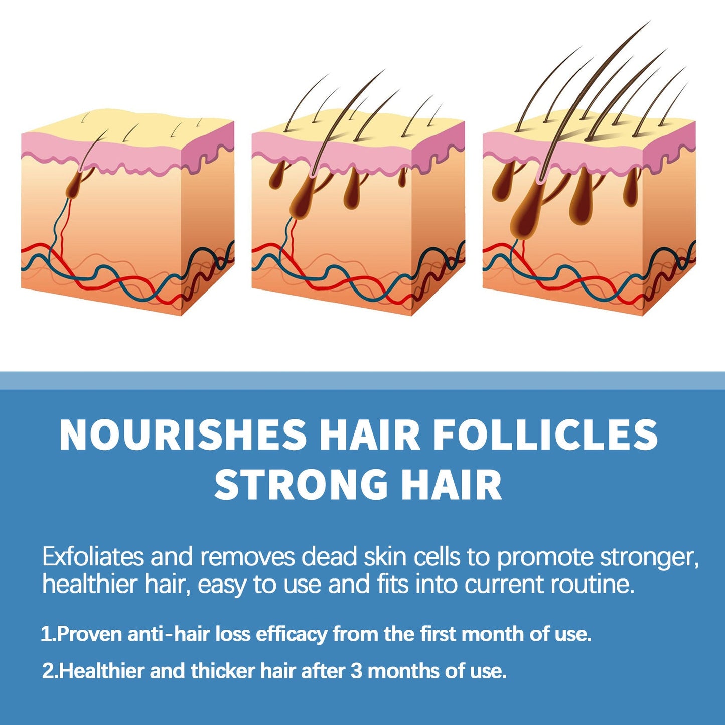 🌿EAST MOON Minoxi Roll-On Hair Treatment