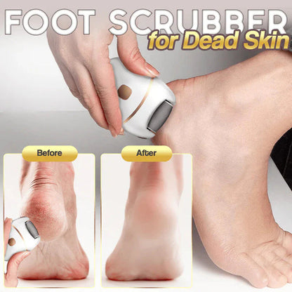⏳ Limited-time offer⏳ Rechargeable electric foot file for calluses Two speeds and removable grinding head USB charging Available in four colors