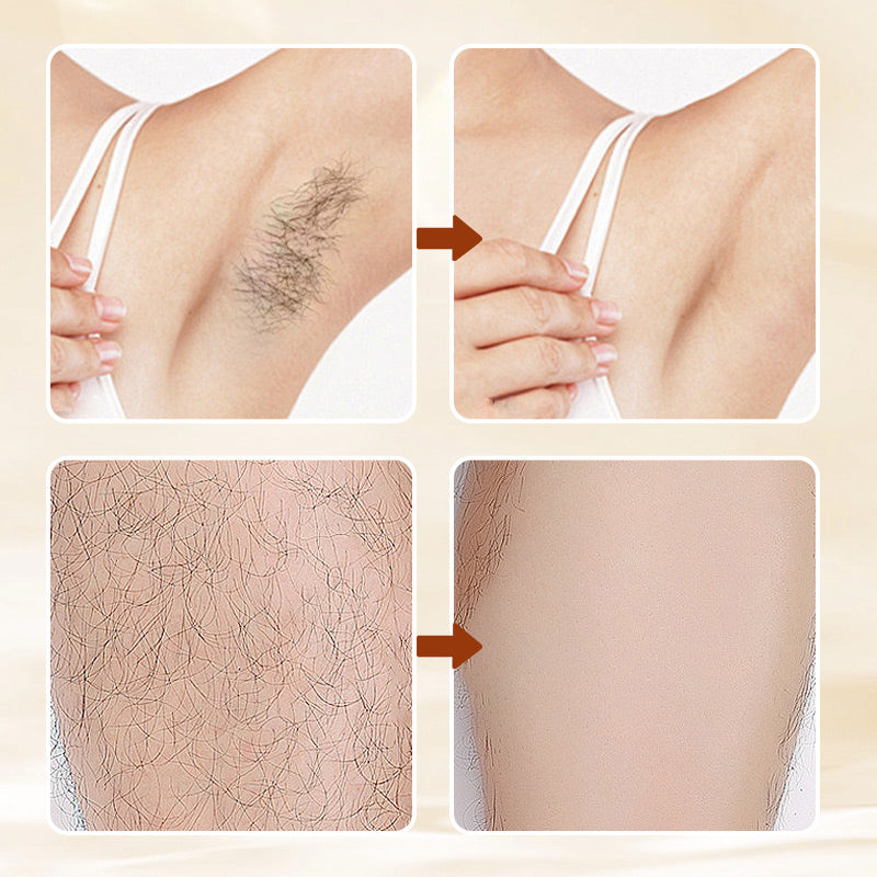 🔥Buy 3 Get 2 Free🔥Versatile Aromatic  Hair Removal Cream 💥