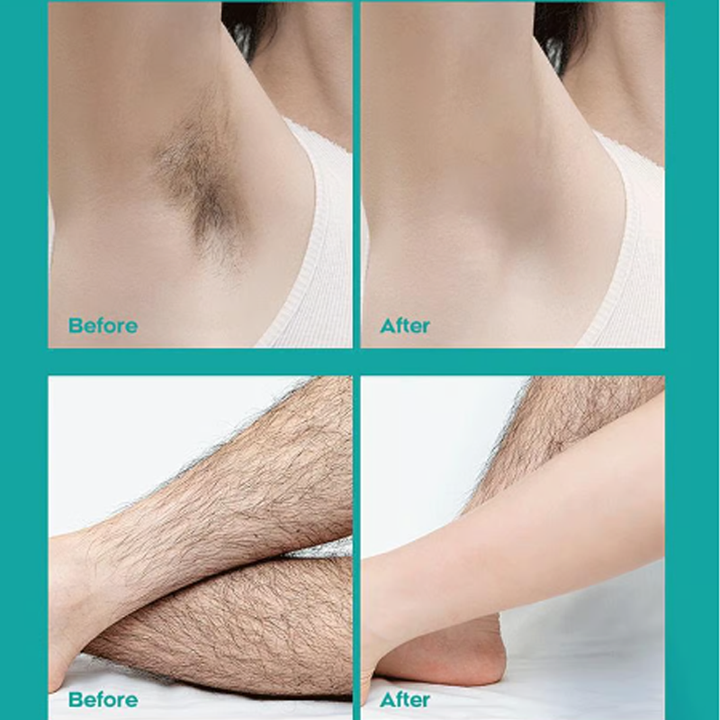 🌟LAST DAY SALE: ONLY ￡9.99!!🎁✨Painless Full Body Hair Removal Cream for Men & Women– Skin-friendly for all areas🌿
