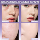 🏖️Summer Hot Sale 50% OFF🌞Matte Concealer for Tattoo and Scars