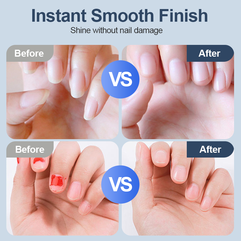 💅 BUY 2 GET 1 FREE! ✨ Universal Automatic Fingernail Grinder - 6 Speed Settings with 5 Attachments for Safe & Gentle Nail Care 👶🔧