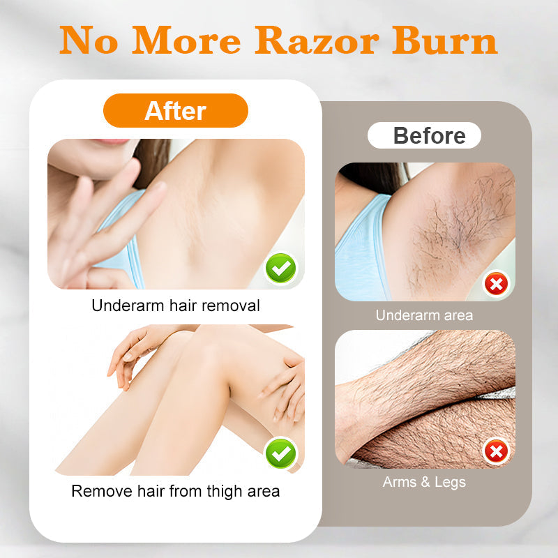 🔥Buy 3 Get 1 Free🔥No Irritation Hair Removal Spray