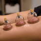 ⏳Time-Limited Special⏰Vacuum Cupping Therapy Set – Thickened, Suction Pump, Transparent 🩺