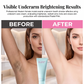 🔥Hot Sale 57% OFF🔥 Gentle Hair Removal Cream for Men & Women – 5-10 Min, Soothing, Sensitive Skin 🌸