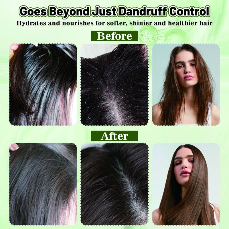 🌿 Rinse-Free Scalp Care Mist